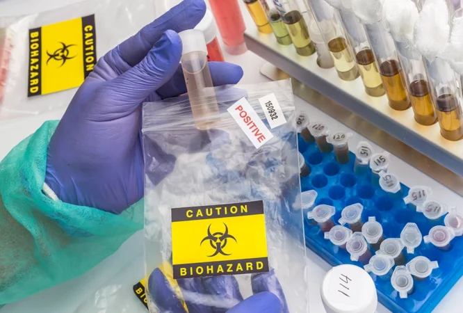 Bloodborne Pathogens