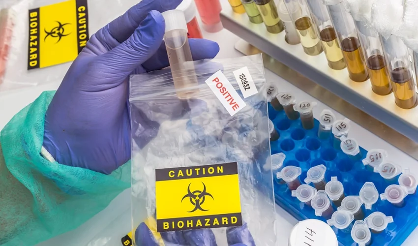 Bloodborne Pathogens Bloodborne Pathogens